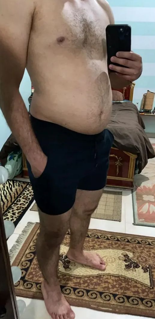 Samy before