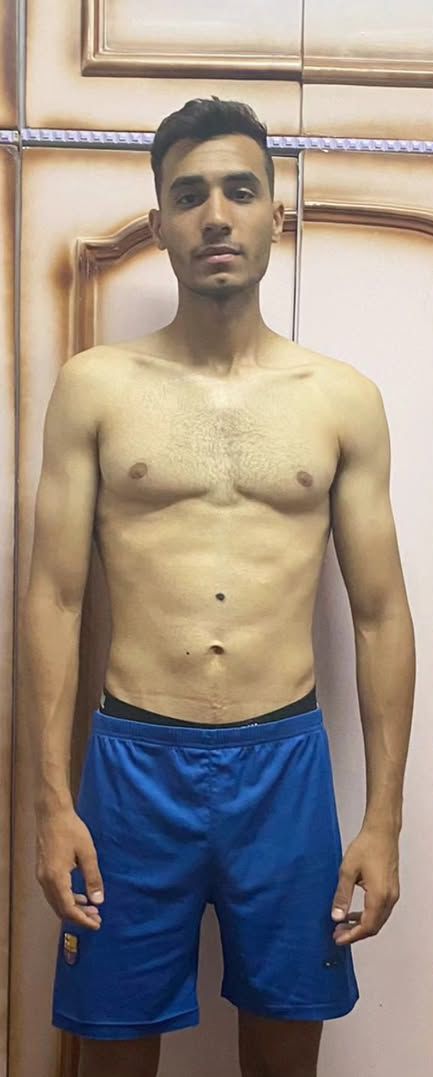 Mahmoud before